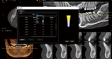 CBCT模拟植体裤学习