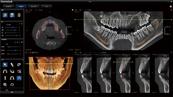 牙医管家显示CBCT影像